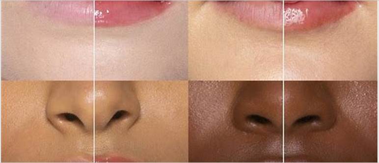 Lip plumper before after